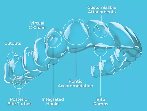健康・医学 Aligner generation Full article: Clear aligners generations and orthodontic